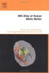 MRI Atlas of Human White Matter(人类白质的核磁共振成像图谱)